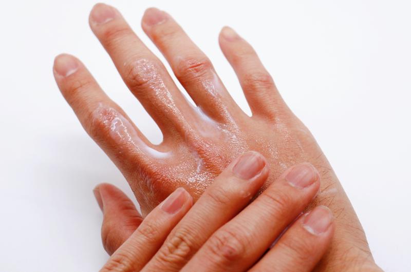 Co se vlastně děje v těle, když vám křupou klouby? Věda má jasno